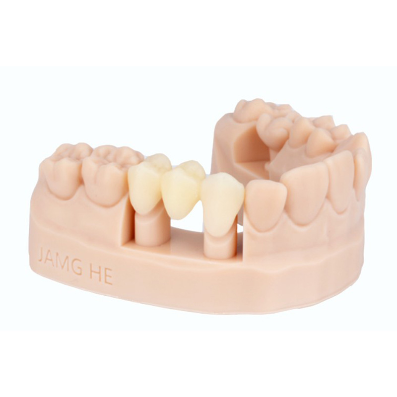 Dental Temporary