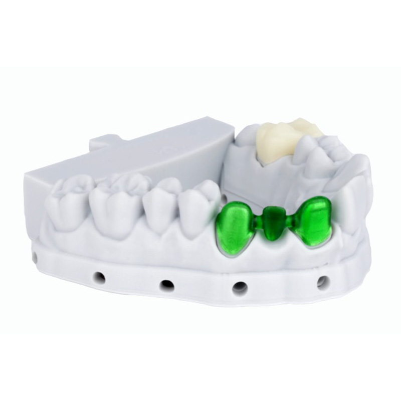 Dental Temporary