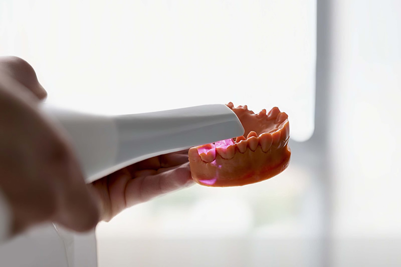 Intraoral Scanner